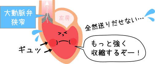 心雑音にはさまざまな種類がありますか?