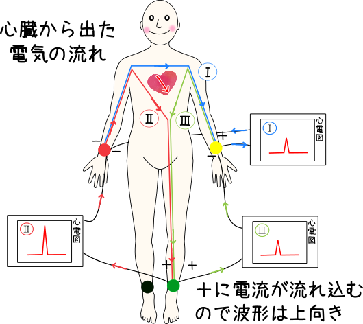 双極誘導,心臓から出た電気の流れのイメージ
