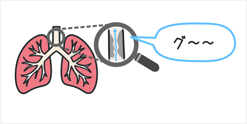 呼吸音の異常(副雑音）④いびき音（Rhonchi）