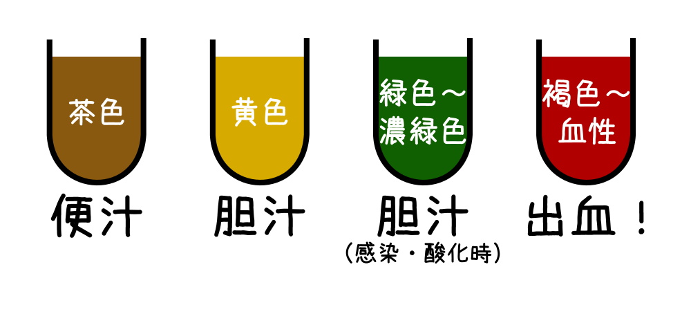 イレウス菅排液の性状