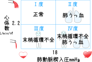 洞不全症候群(SSS) | 見て！わかる！病態生理と看護【花子のまとめノート】