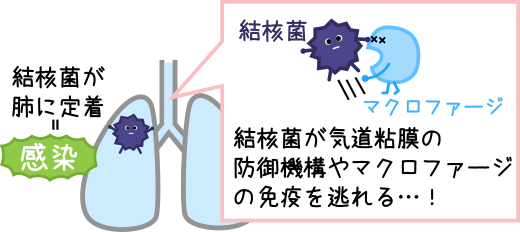 結核菌がマクロファージの免疫を逃れるイメージ図