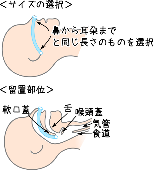経鼻エアウエイの挿入方法と挿入位置