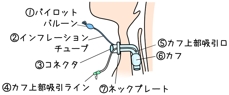 気管切開による生活の質