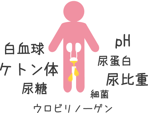 尿 pH レベル検査の準備はどのようにすればよいですか?